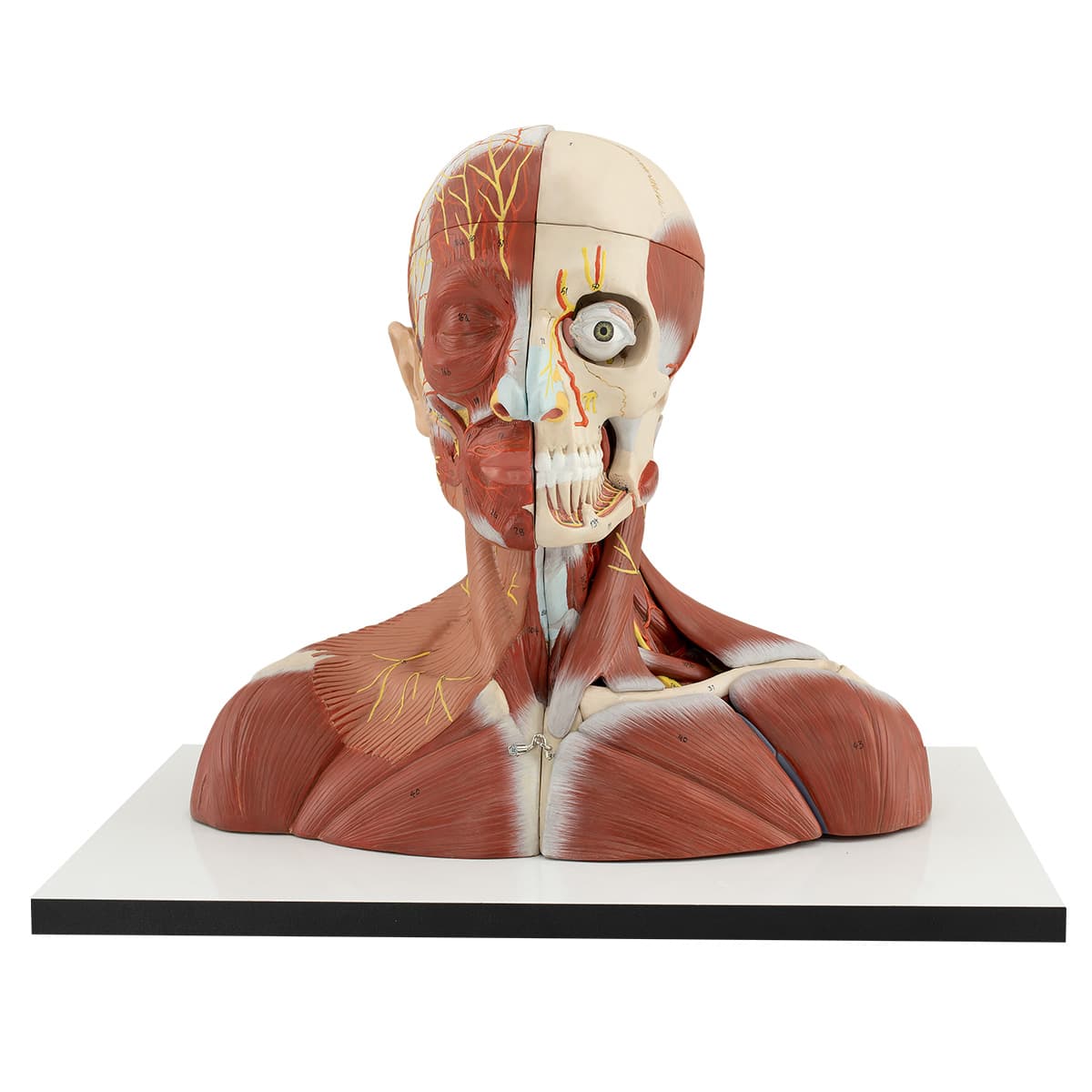 Head And Neck (KPB 02)